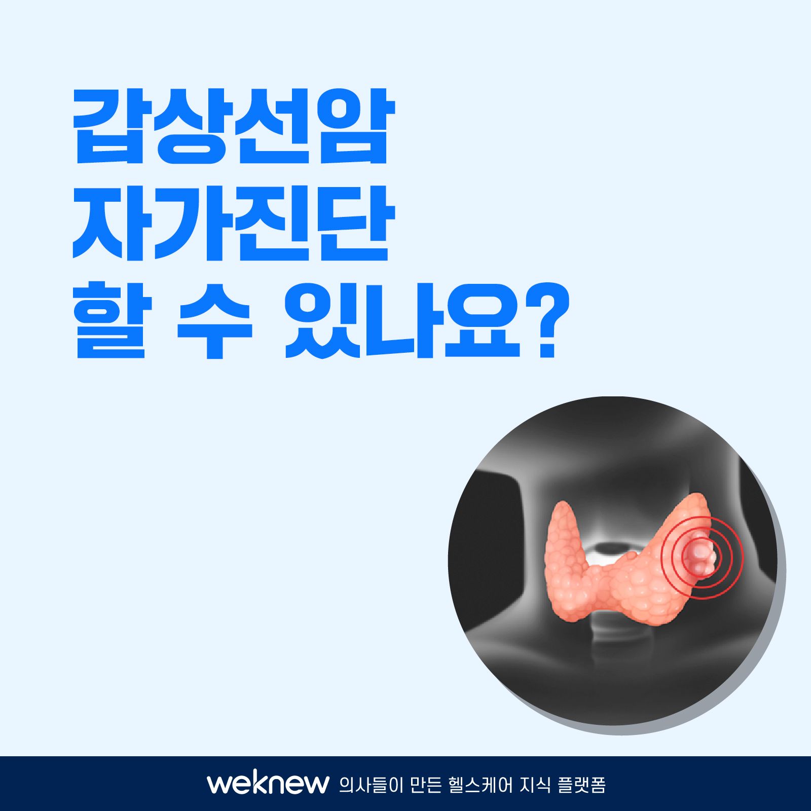 배너